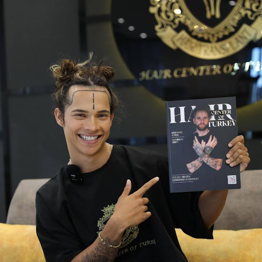 Hair Transplant Tourism on the Rise in Turkey