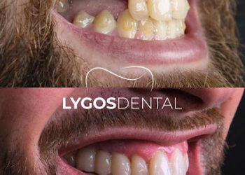 Why Turkey Became a Popular Destination for Dental Treatments in 2025