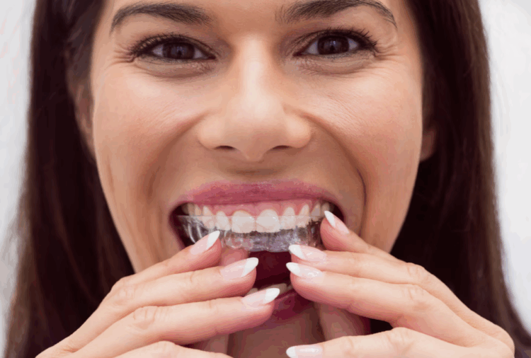 Cosmetic Dentistry in Dana Point: From Teeth Whitening to Invisalign