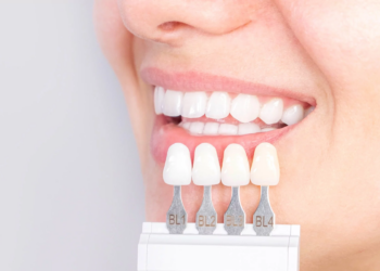 Why Modern Dental Crowns & Implants Are More Natural Than Ever
