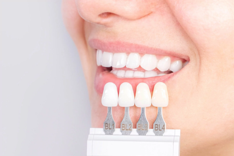 Why Modern Dental Crowns & Implants Are More Natural Than Ever