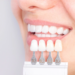 Why Modern Dental Crowns & Implants Are More Natural Than Ever