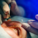 Laser Eye Surgery Cost Guide in Melbourne: What You Need to Know Before Booking