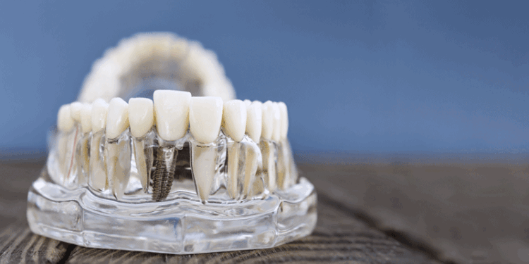 Dental