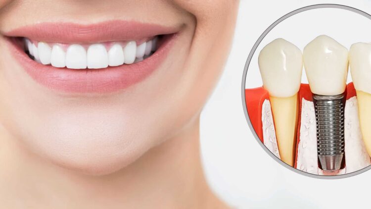 Dental