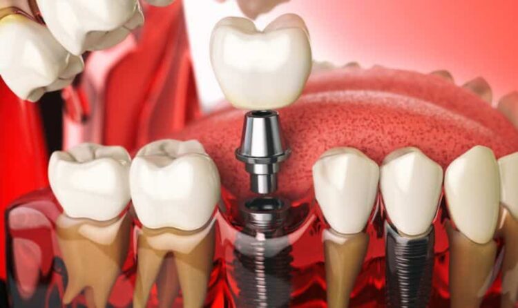 Tooth