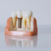 What Really Happens When You Put Off Replacing a Missing Tooth