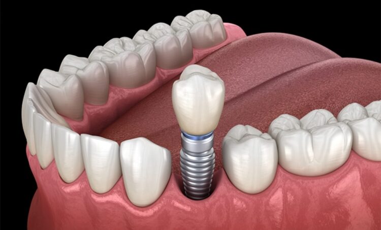 Dental